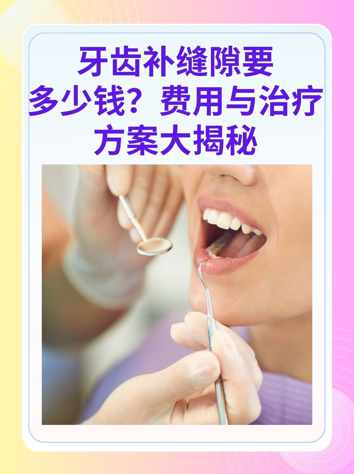 清远补牙医保可以报销吗(补牙医保可以报销吗 哪些可以报销呢)